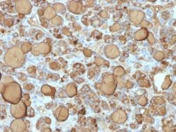 Thyroglobulin Antibody (TGB/1968R) - Azide and BSA Free, Novus Biologicals